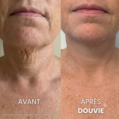 Douvie™ Crème Tenseur & Raffermissante Cou