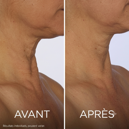 Douvie™ Crème Tenseur & Raffermissante Cou