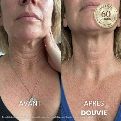 Douvie™ Crème Tenseur & Raffermissante Cou