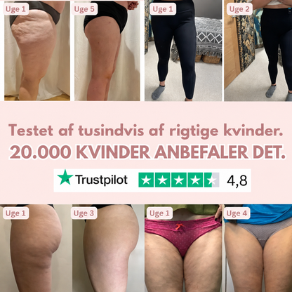 3D Anti-Cellulite Leggings